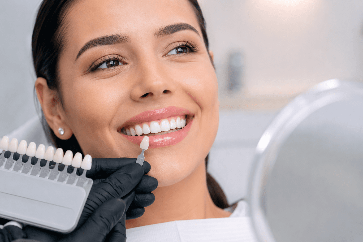 Materiales de estética dental