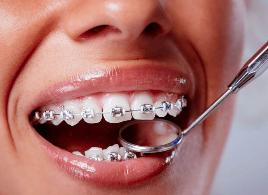 Odontología preventiva explicada