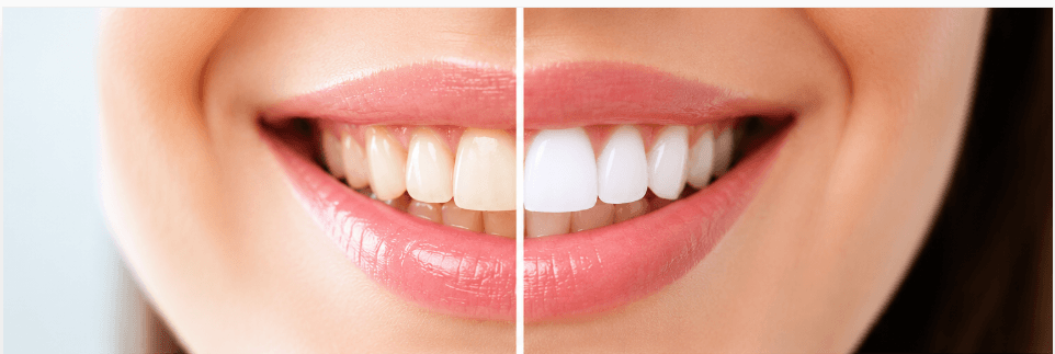 Planificación estética dental en ELARA